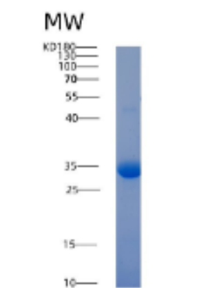 Recombinant Human ACP5 Protein