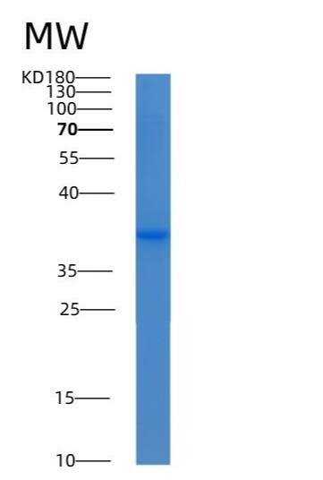 Recombinant Human AKR7A3 Protein
