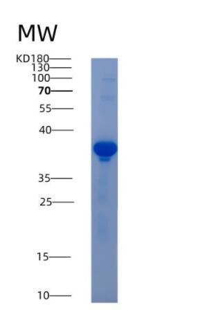 Recombinant Human AKR1D1 Protein