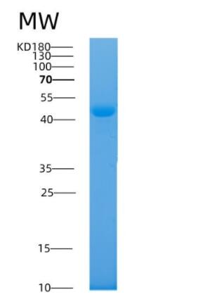 Recombinant Human AKR7A2 Protein