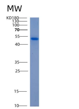 Recombinant Human ALDH5A1 Protein