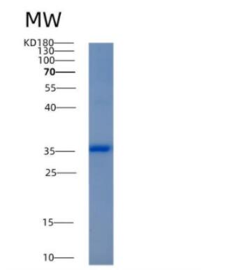 Recombinant Human Aldo-keto reductase family 1 member C4 Protein