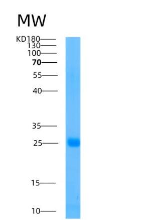 Recombinant Human AMBP Protein