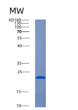 Recombinant Human AMELX Protein
