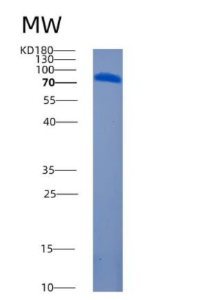 Recombinant Human AMPD2 Protein