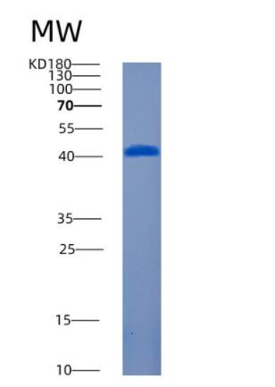 Recombinant Human Amphoterin-induced protein 2 Protein
