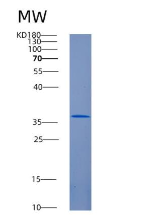 Recombinant Human ANKRA2 Protein