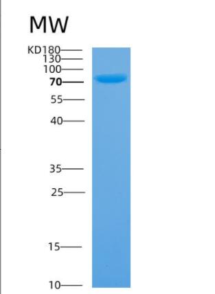 Recombinant Human Annexin A6 Protein