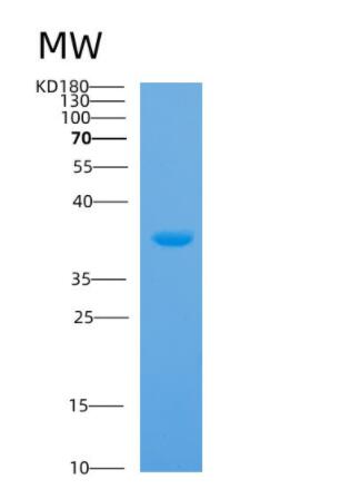 Recombinant Human Anxa5 Protein