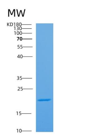 Recombinant Human APOM Protein