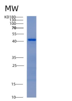 Recombinant Mouse Aldoc Protein