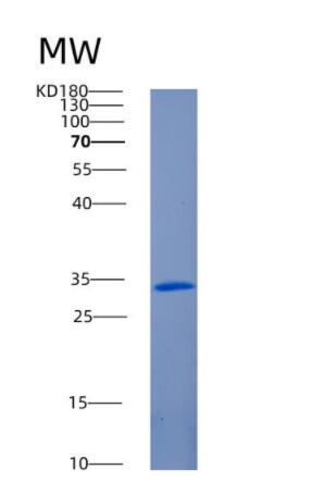 Recombinant Human ANKRD54 Protein