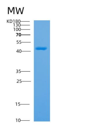 Recombinant Human APMAP Protein