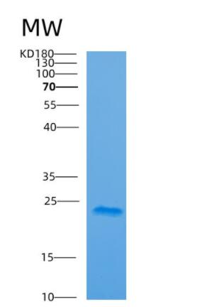 Recombinant Human ARF5 Protein