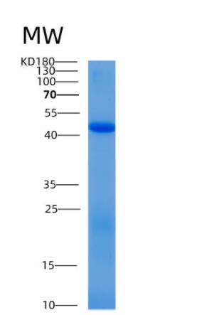 Recombinant Human Alix Protein