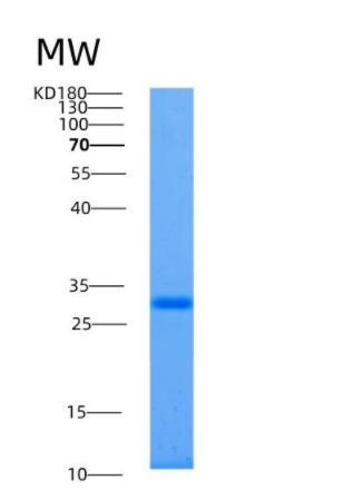 Recombinant Human ALKBH2 Protein
