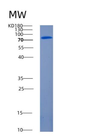 Recombinant Mouse Angiopoietin-1 receptor Protein