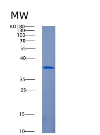 Recombinant Human ANKRD1 Protein