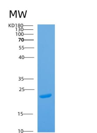 Recombinant Human ARL11 Protein