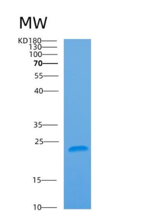 Recombinant Human ARL5A Protein