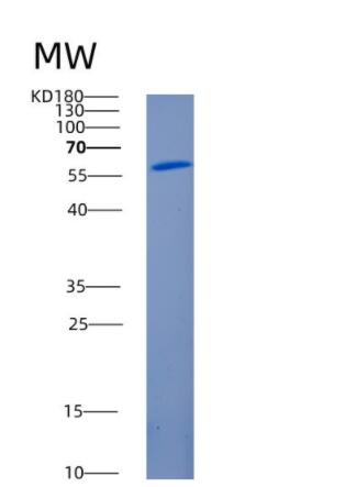 Recombinant Human ANGPTL2 Protein