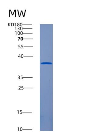 Recombinant Human AMN Protein