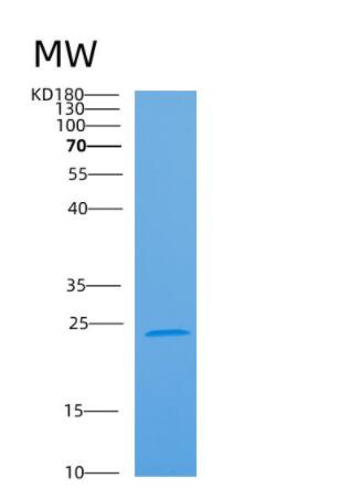 Recombinant Human ARL6 Protein