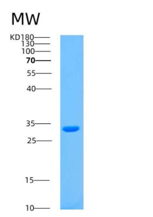 Recombinant Human ASB13 Protein