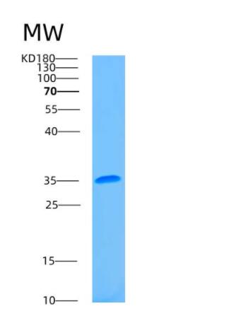 Recombinant Human ASMT Protein