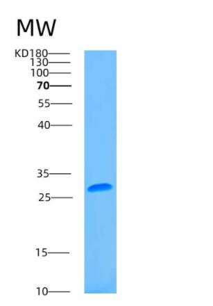 Recombinant Human ASGR2 Protein