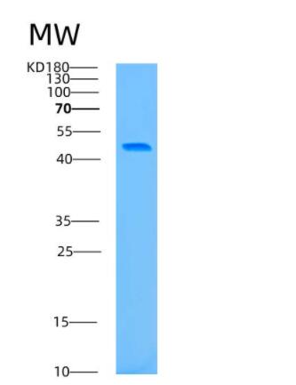 Recombinant Human ATG4B Protein