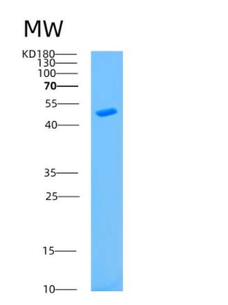 Recombinant Human ASS1 Protein