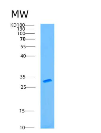 Recombinant Human ATP1B1 Protein