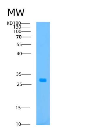 Recombinant Human ATP1B2 Protein