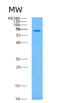 Recombinant Human ASPSCR1 Protein
