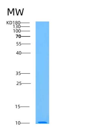 Recombinant Human ATOX1 Protein