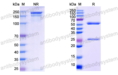 抗体：EBV/HHV-4 LMP1/BNLF1 Antibody (H3) RVV07011