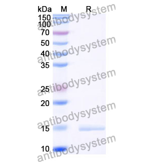 Anti-Porphyromonas gingivalis porM Nanobody (SAA0959)
