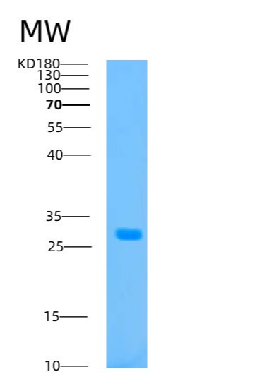 Recombinant Human ATP1B2 Protein.