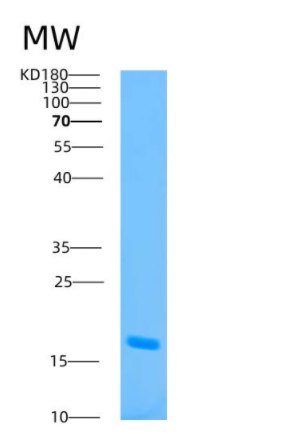 Recombinant Human ATP5D Protein