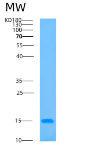 Recombinant Human B2M Protein