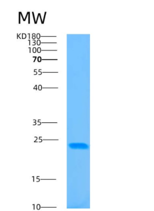 Recombinant Human 4-1BB ligand Protein