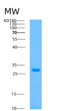 Recombinant Human ATP1B3 Protein