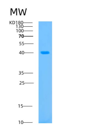 Recombinant Human Aurora Kinase B Protein