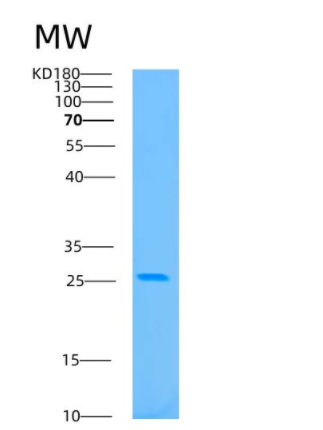Recombinant Human BAG2 Protein