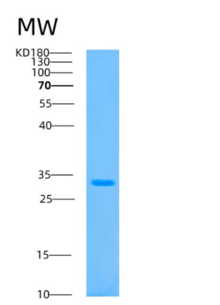 Recombinant Human ATP5C1 Protein