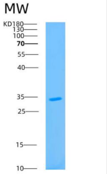 Recombinant Human AUH Protein
