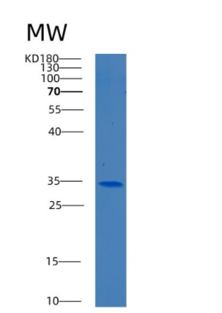 Recombinant Human BEND6 Protein