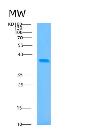 Recombinant Human BABAM1 Protein