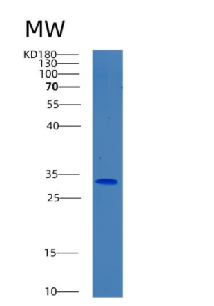 Recombinant Human BPGM Protein